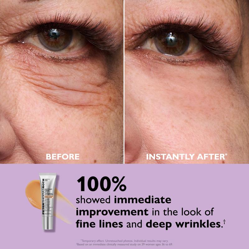 Instant Eye tightener