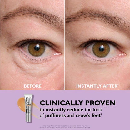 Instant Eye tightener
